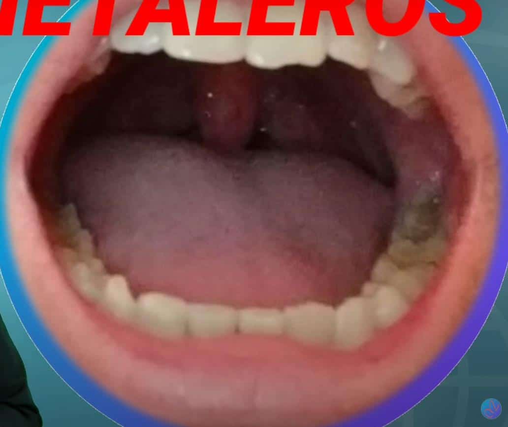 lengua en la base de la mandíbula