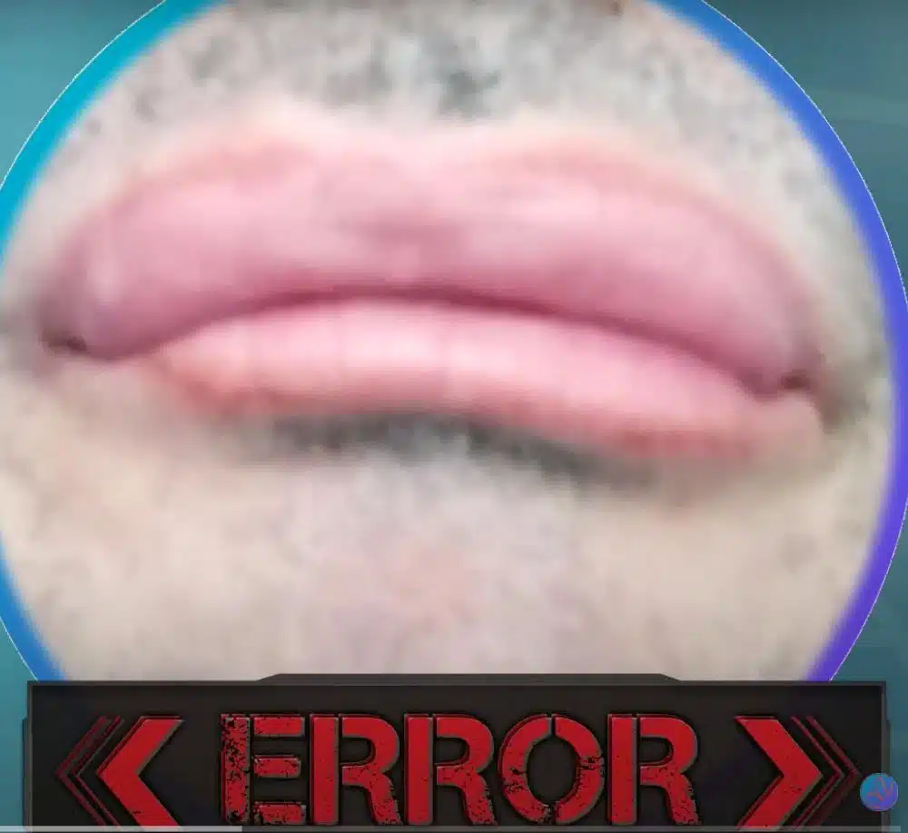 punto de vibración de los labios sin control